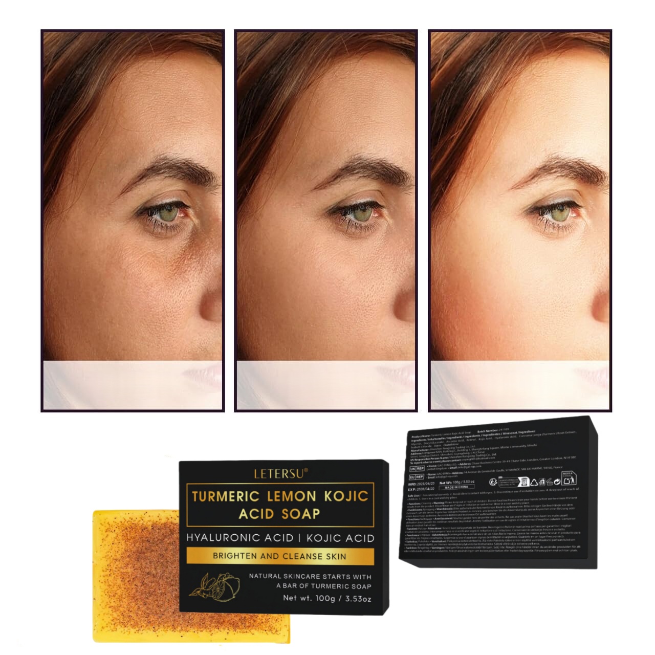 Turmeric Lemon Kojic Acid Soap - Kojic Acid Soap のレビューと価格