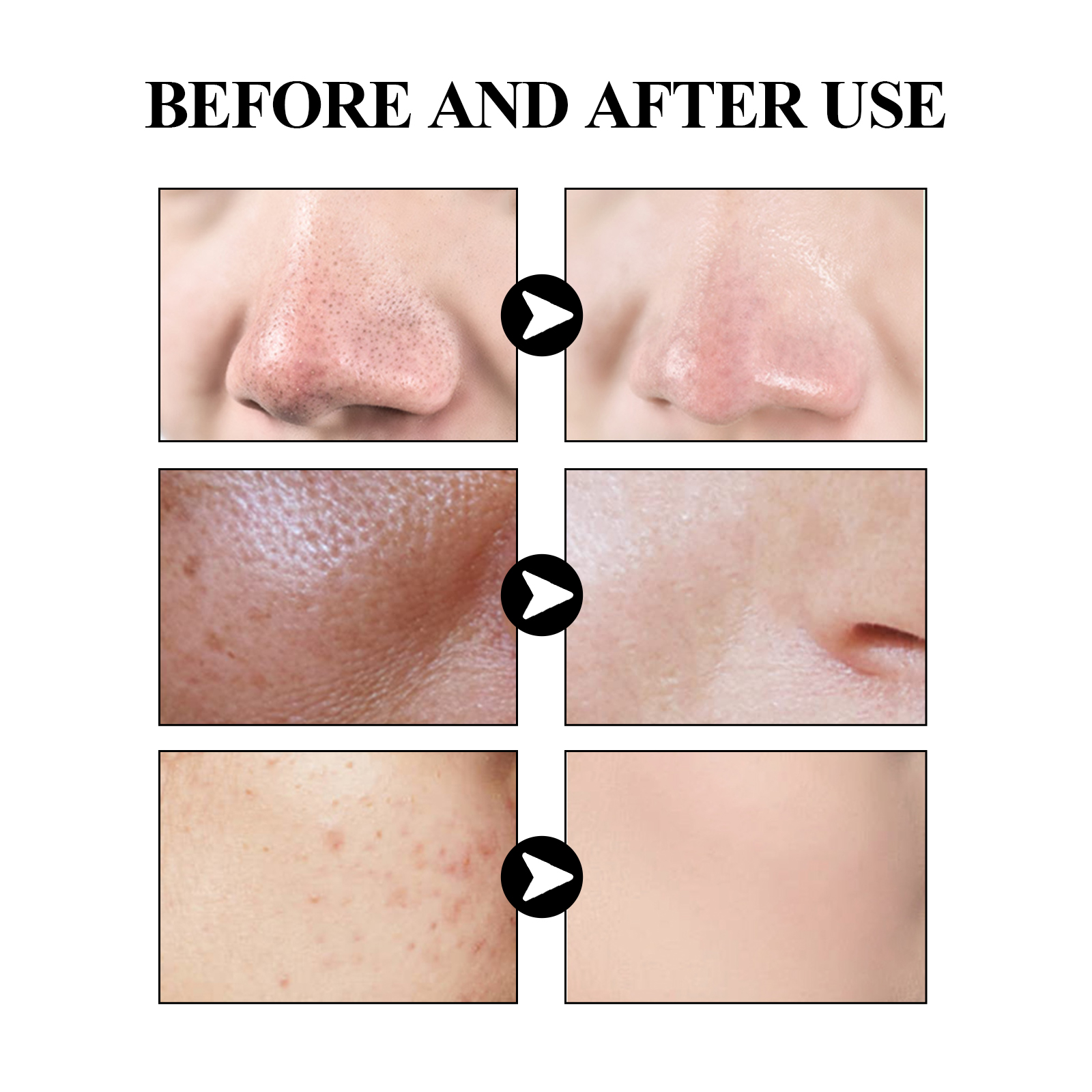 40g Activated carbon facial ma - Mud Mask Kaolin のレビューと価格