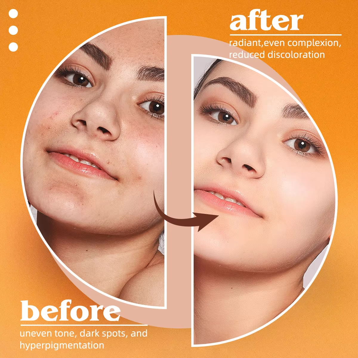 Kojic Acid Natural Papaya Soap - Kojic Acid Soap のレビューと価格