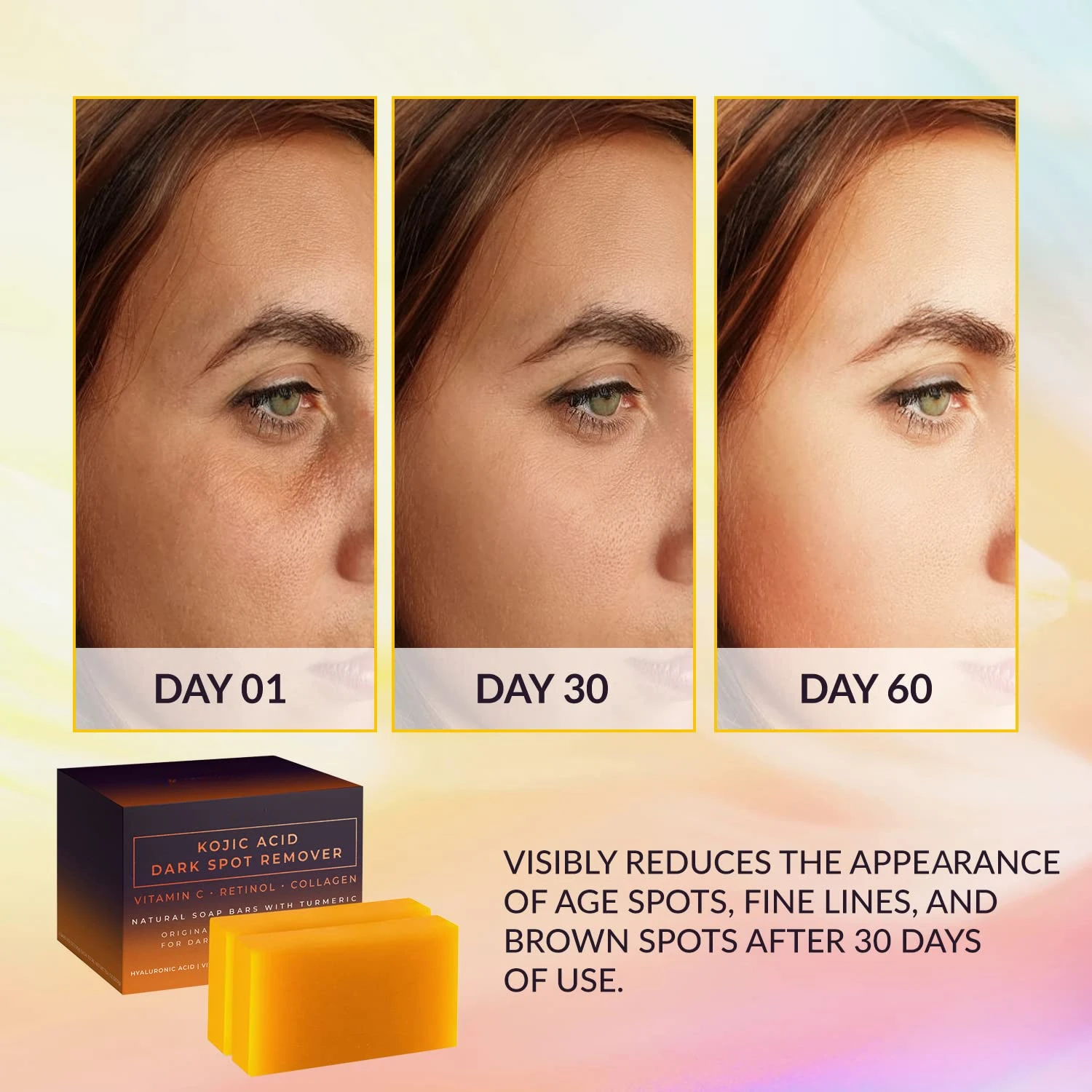 Kojic Acid Dark Spot Remover W - Kojic Acid Soap のレビューと価格