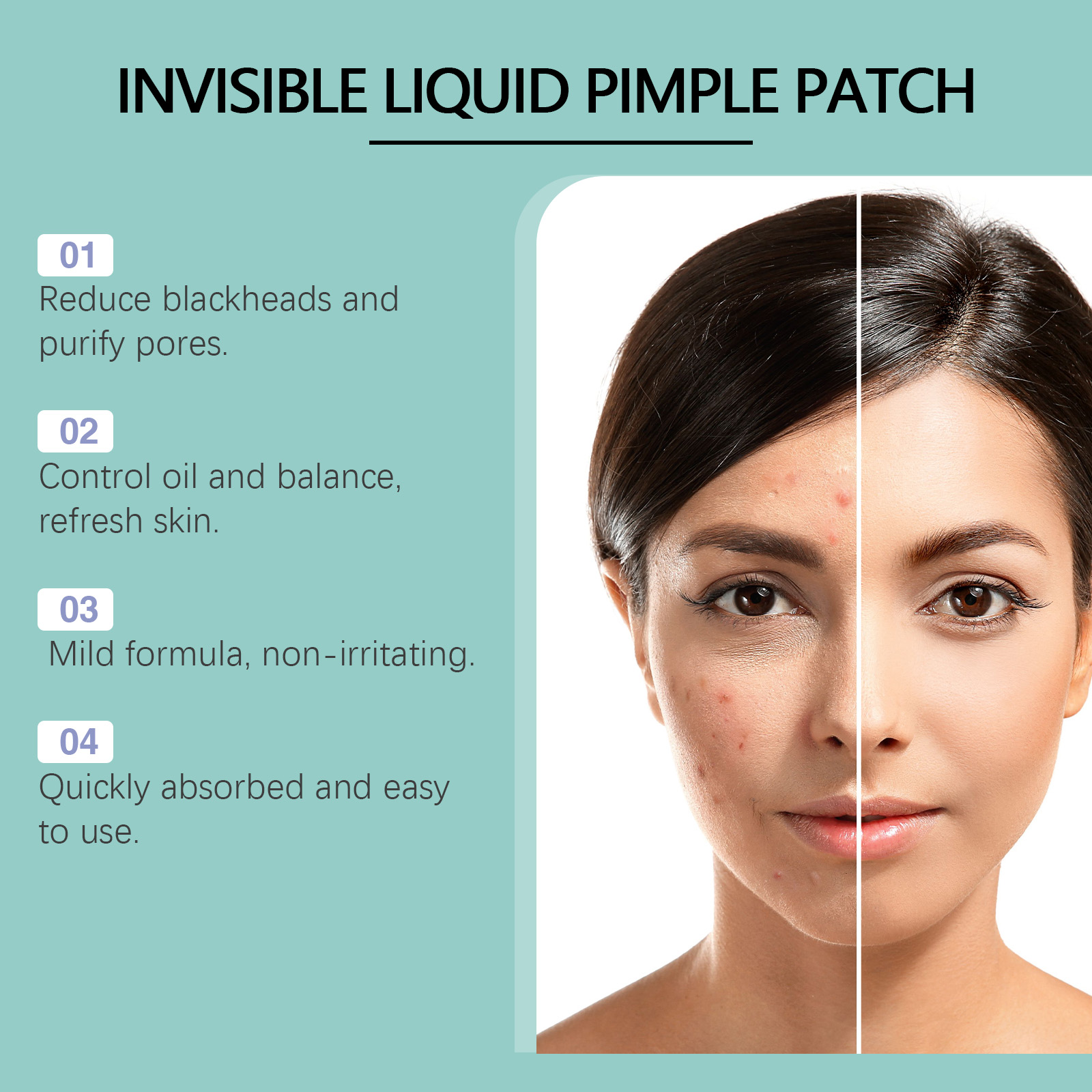 Acne Repair Facial Serum Light - Licorice Root Extract のレビューと価格