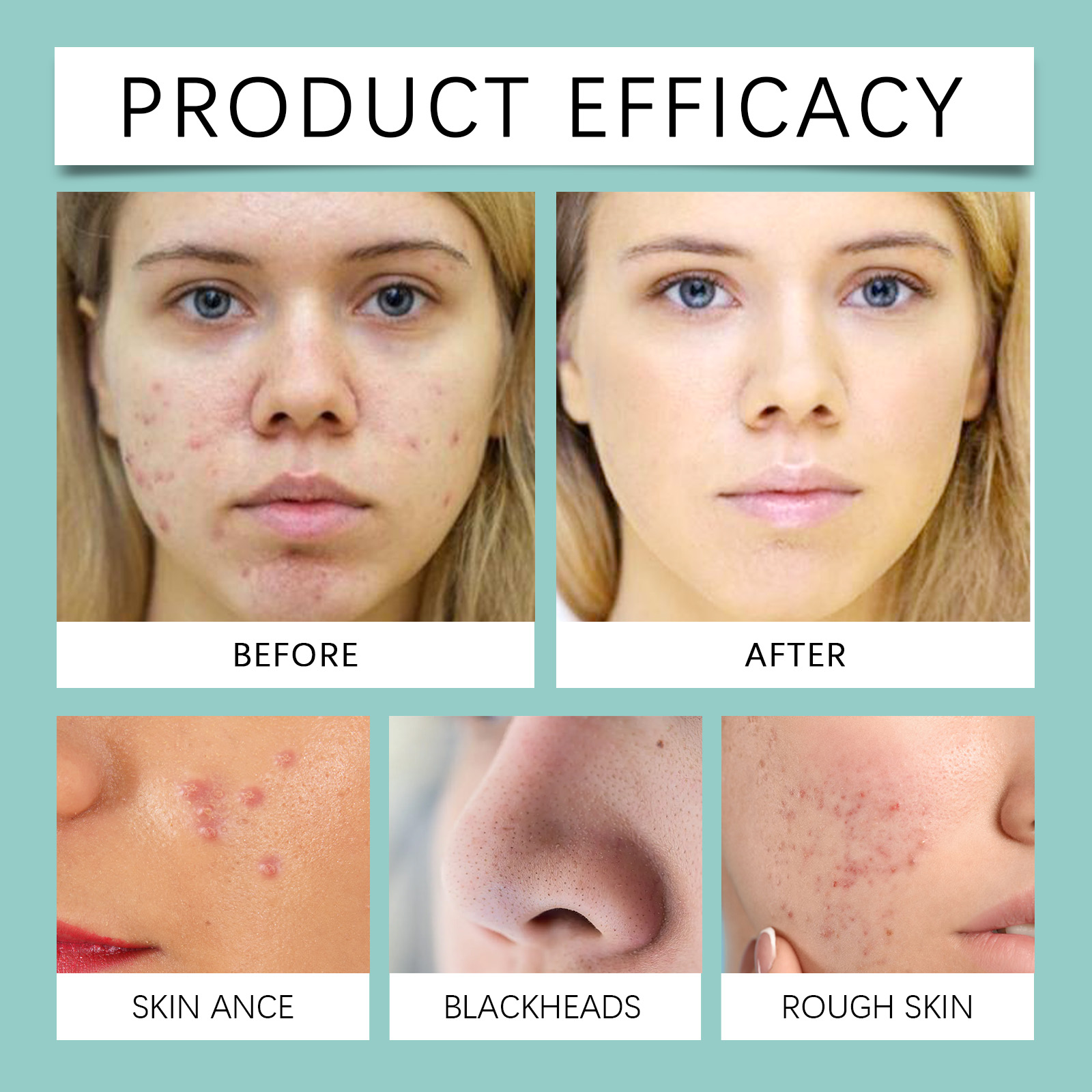 Acne Repair Facial Serum Light - Licorice Root Extract のレビューと価格